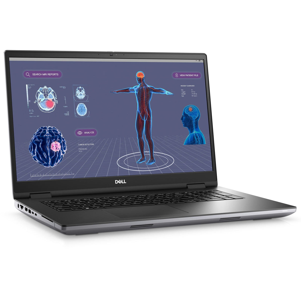 Dell Precision 7780 Laptop: i7-13850HX RTX 3500 Ada 32GB RAM 512GB SSD Warranty