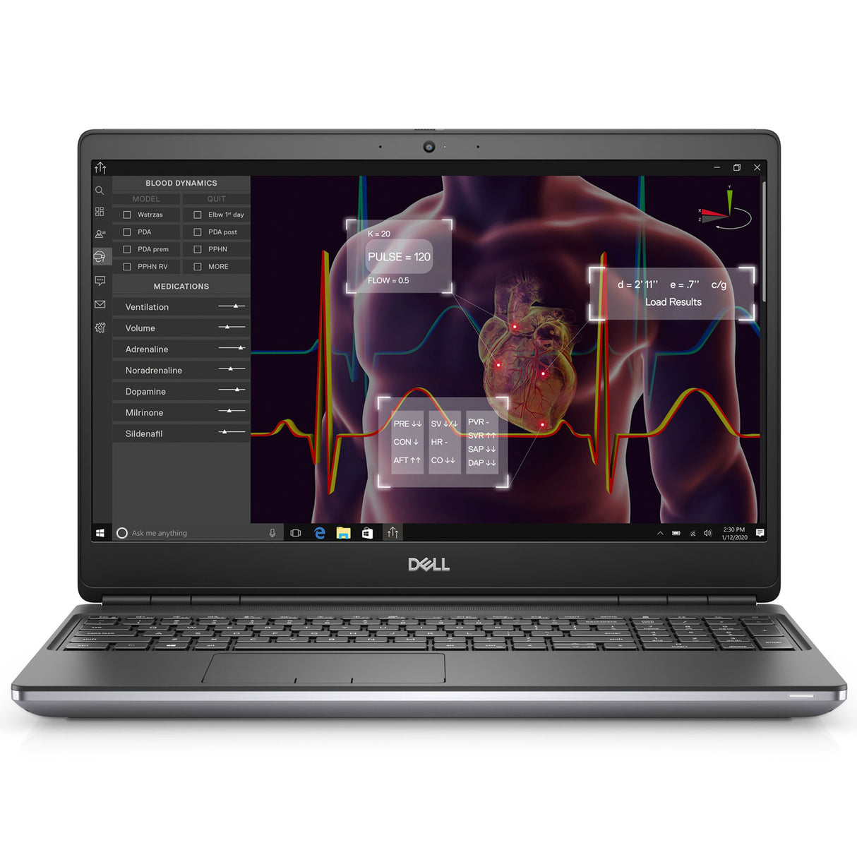 Dell Precision 7750 Laptop: Xeon W-10885M, RTX 5000, 2TB SSD, 64GB RAM, Warranty - GreenGreen Store